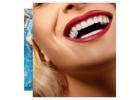 Soda City Dentistry: Premier Veneers in Columbia, SC