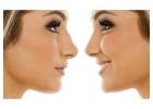 Best Rhinoplasty ((Nose Job))Surgeon in Delhi India - Cost(₹) and Procedurex`