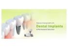 Quality Dental Implants in India