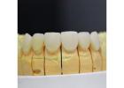 Transform Smiles with Emax Porcelain Veneers from Midway Dental Lab