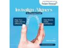 In****lign Aligners in Hyderabad - Asian Dental