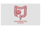 Highly Recommended Colorectal Surgeon in Glendale – Schedule Today!