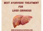 Best Ayurvedic treatment  For Liver cirrhosis | Dr. Sharda Ayurveda