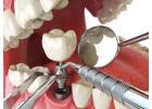 Dr. Helen’s Dental & Implant Studio- Best Dental Implants in Melbourne