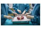 Kidney Transplant Surgery | Maddadgar Foundation