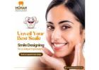 Smile Correction Treatment in Hyderabad - Mohan Dental