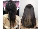 Hair Extensions For Trichotilomania