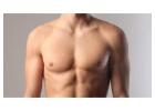 Male Breast Reduction Treatment In Los Angeles