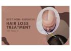 Best Non-Surgical Hair Loss Treatment – Try Today!