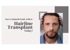 Get a Natural Look with a Hairline Transplant Today!