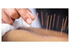 Acupuncture Thornhill: A Natural Healing Approach at King Thai Massage Health Care Centre