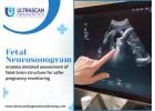 Advanced Fetal Neurosonogram Imaging at Ultrascan Indore