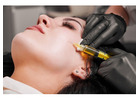 PRP Treatment in Delhi for Natural Hair Restoration and Skin Rejuvenation
