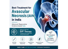 Best Treatment for Avascular Necrosis (AVN) in India