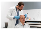 Scalp Micropigmentation in Delhi – Natural Hair Density at Iksana Wellness