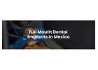 Full Mouth Dental Implants in Mexico with Teeth Savers